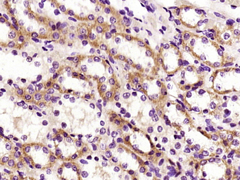FBXO44 Rabbit Polyclonal Antibody