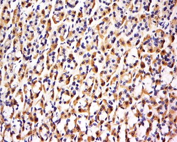 FBXO48 Rabbit Polyclonal Antibody