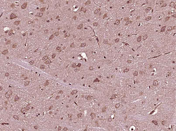 FGD5 Rabbit Polyclonal Antibody