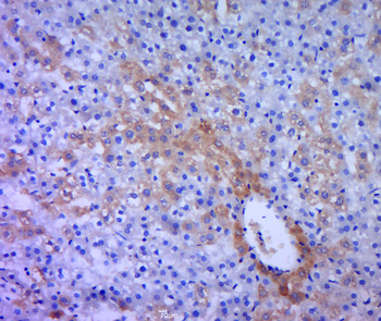 FITM1 Rabbit Polyclonal Antibody