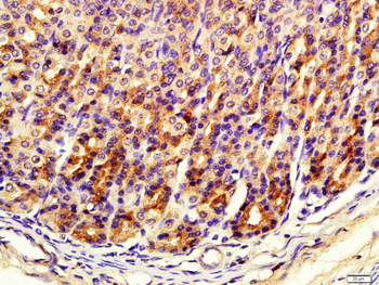 FITM1 Rabbit Polyclonal Antibody