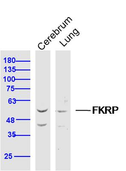 FKRP Rabbit Polyclonal Antibody