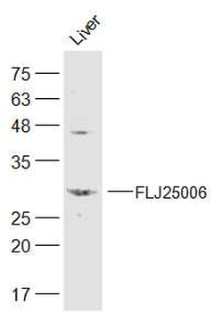 FLJ25006 Rabbit Polyclonal Antibody