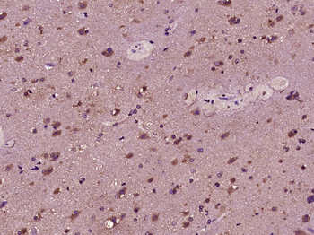 FLJ27365 Rabbit Polyclonal Antibody
