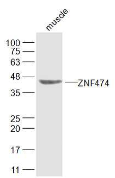 ZNF474 Rabbit Polyclonal Antibody