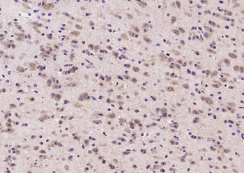FLJ39155 Rabbit Polyclonal Antibody