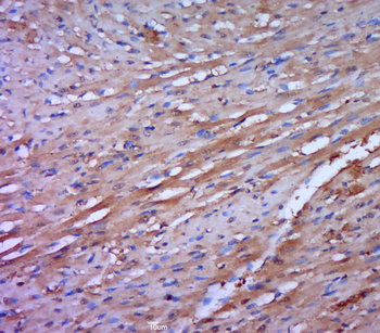 FLJ39378 Rabbit Polyclonal Antibody