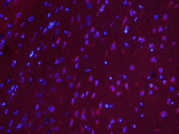 RUFY4/FLJ46536 Rabbit Polyclonal Antibody