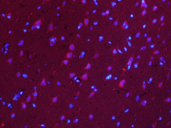 RUFY4/FLJ46536 Rabbit Polyclonal Antibody