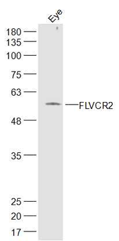 FLVCR2 Rabbit Polyclonal Antibody