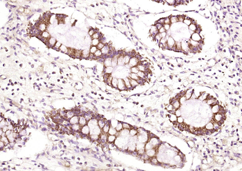FMNL3 Rabbit Polyclonal Antibody