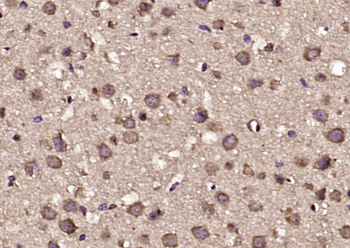 FOXK1 Rabbit Polyclonal Antibody