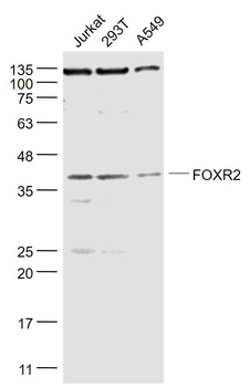 FOXR2 Rabbit Polyclonal Antibody