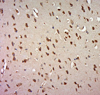 FRRS1 Rabbit Polyclonal Antibody