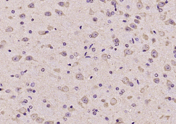 FSIP2 Rabbit Polyclonal Antibody
