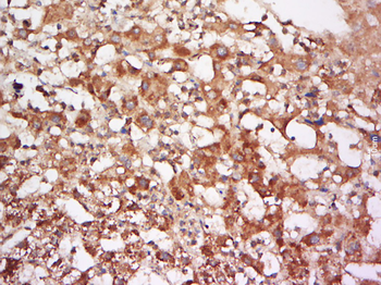 FUCA2 Rabbit Polyclonal Antibody