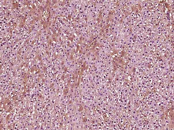 FGL2 Rabbit Polyclonal Antibody