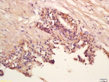 GCDFP15 Rabbit Polyclonal Antibody