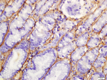 Gastrokine 1 Rabbit Polyclonal Antibody