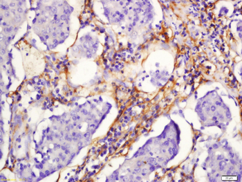 Gastrokine 1 Rabbit Polyclonal Antibody