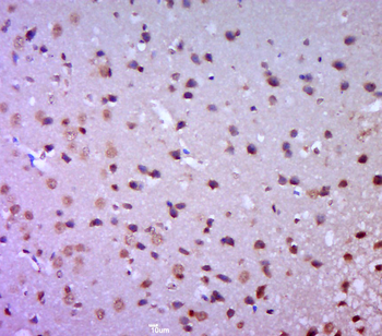 GAK Rabbit Polyclonal Antibody