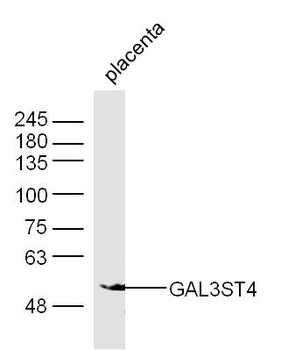 GAL3ST4 Rabbit Polyclonal Antibody