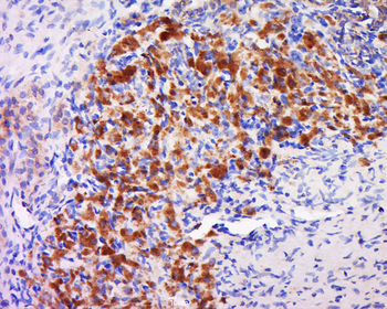 GAL3ST4 Rabbit Polyclonal Antibody
