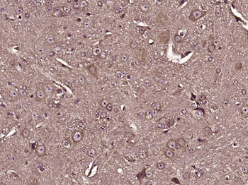 GLOD4 Rabbit Polyclonal Antibody
