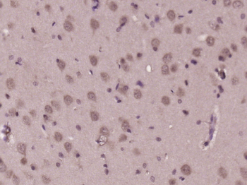 GLOD5 Rabbit Polyclonal Antibody
