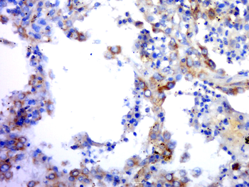 GPCR150 Rabbit Polyclonal Antibody