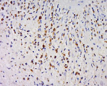GPIHBP1 Rabbit Polyclonal Antibody
