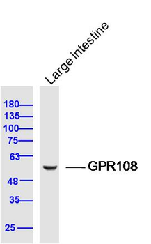 GPR108 Rabbit Polyclonal Antibody