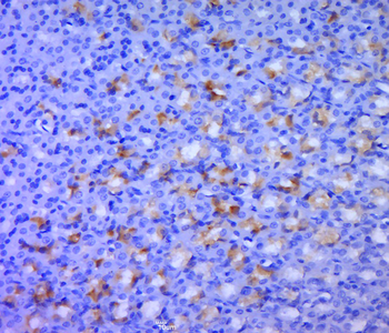 GPT2 Rabbit Polyclonal Antibody
