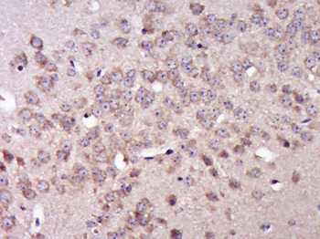 GRHPR Rabbit Polyclonal Antibody