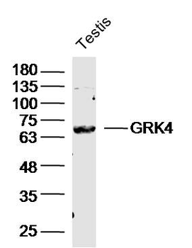 GRK4 Rabbit Polyclonal Antibody