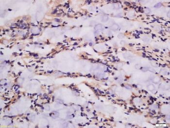 GSDMA Rabbit Polyclonal Antibody