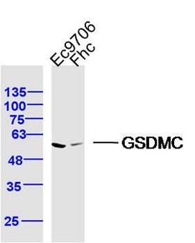 GSDMC Rabbit Polyclonal Antibody