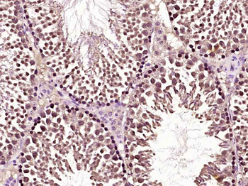 GTF2IRD2 Rabbit Polyclonal Antibody