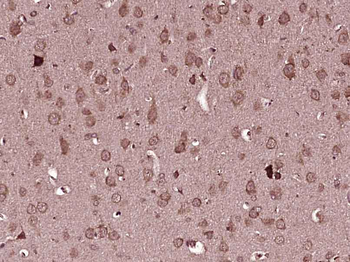 GTL3 Rabbit Polyclonal Antibody