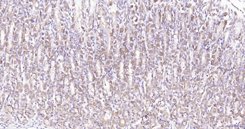 GW182 Rabbit Polyclonal Antibody