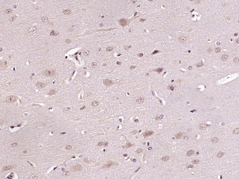 Phospho-GRK2 (Ser29) Rabbit Polyclonal Antibody