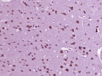 GAL Rabbit Polyclonal Antibody