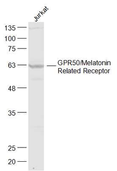 GPR50/Melatonin Related Receptor Rabbit Polyclonal Antibody