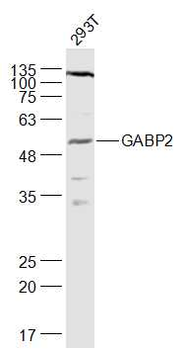 GABP2 Rabbit Polyclonal Antibody