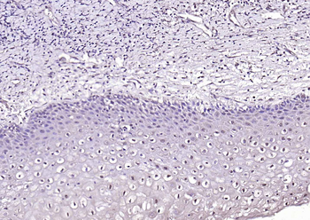 HPV16 E7 Rabbit Polyclonal Antibody
