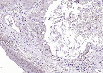 HPV16 E7 Rabbit Polyclonal Antibody