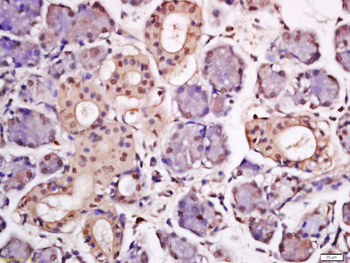 HPV16 E7 Rabbit Polyclonal Antibody