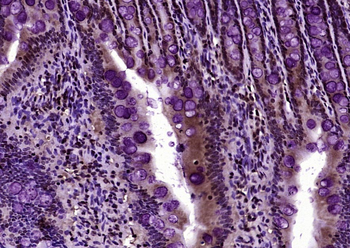 Histone H3 (acetyl K27) Rabbit Polyclonal Antibody