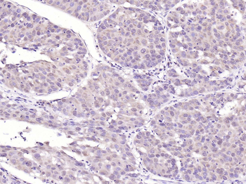 Histone H4 (tri methyl K20) Rabbit Polyclonal Antibody