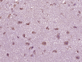Phospho-HSF1 (Thr142) Rabbit Polyclonal Antibody